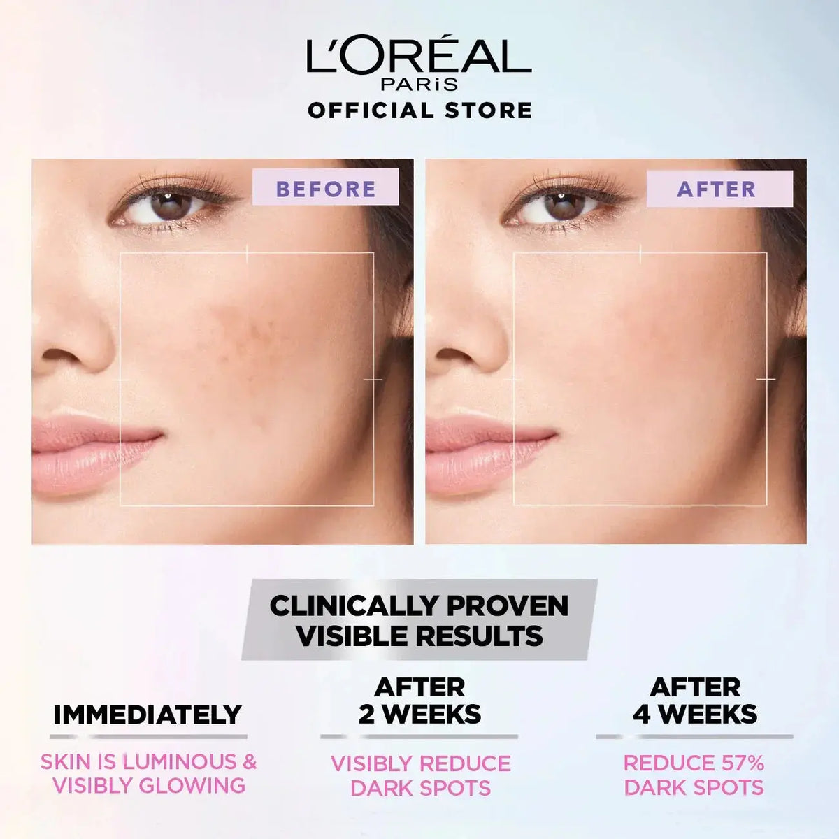 L’Oréal Paris Glycolic-Bright Instant Glowing Serum 15ml - LAB BEAUTY