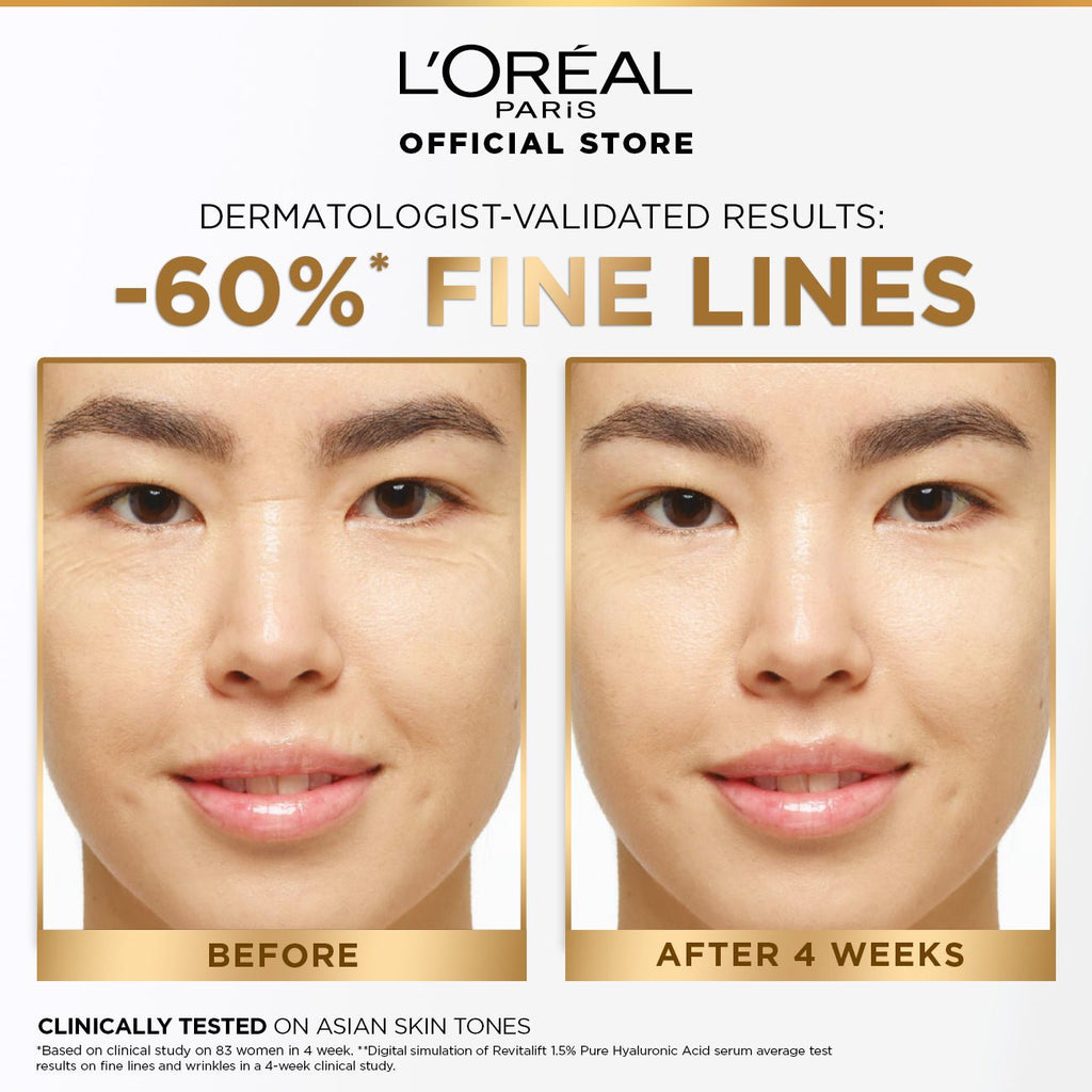 L’Oréal Paris Revitalift 1.5% Hyaluronic Acid Serum 30 ml