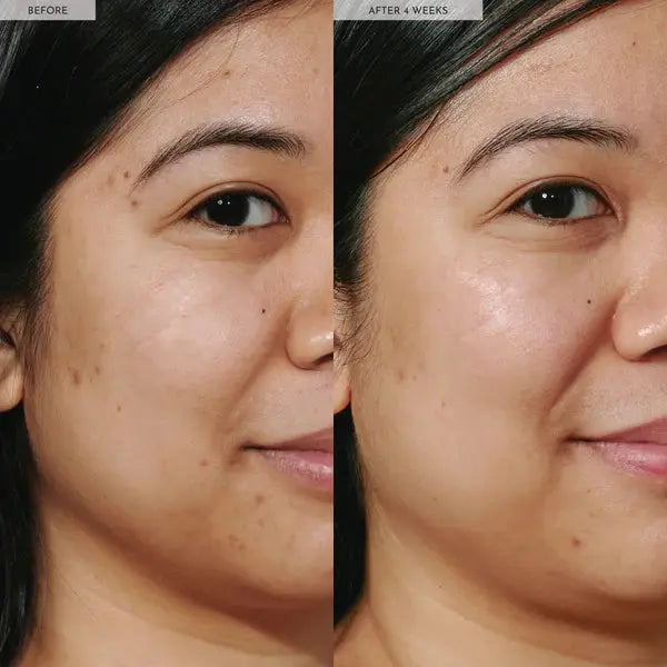 Glow Recipe Watermelon Glow Niacinamide Dew Drops – Ultimate Glow & Brightening Serum LAB BEAUTY