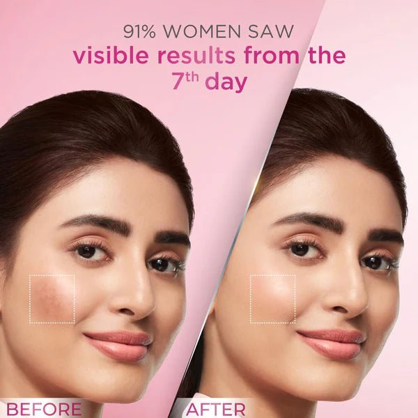 Pond’s Bright Beauty Anti-Pigmentation Serum with 12% Gluta-Niacinamide (15ml)