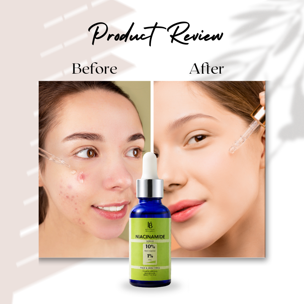 Before and after comparison of a woman's face with a skincare product bottle labeled 'Niacinamide 10% + Zinc 1%'.